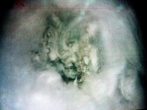 Inilah wajah langsuir yang ditangkap oleh seorang bomoh. Dimana cerita penangkapan hantu ini pernah menjadi tajuk utama akhbar dan tajuk utama berita di Malaysia